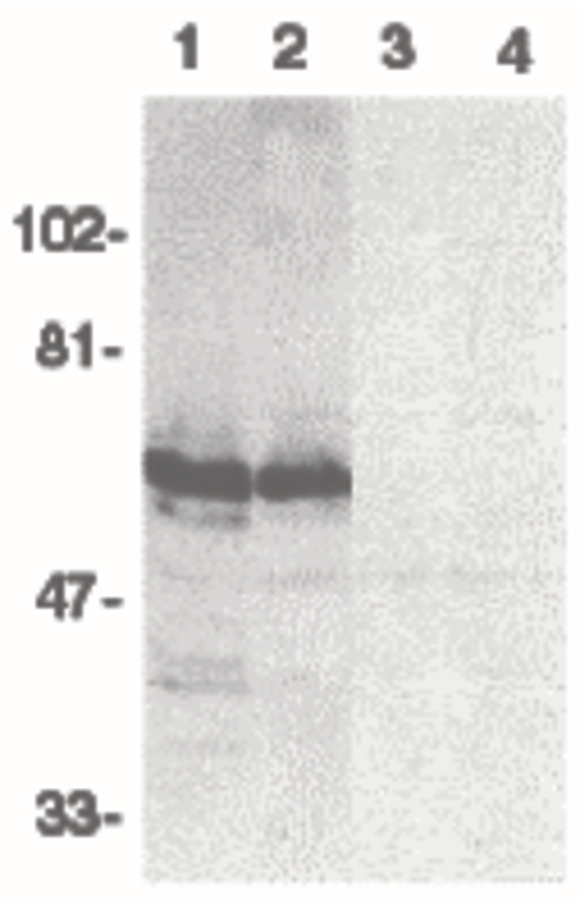 Western blot of SODD in HeLa (1,3) and THP-1 (2,4) whole cell lysates in the absence (1,2) or presence (3,4) of blocking peptide with SODD antibody at 1:500 dilution.
