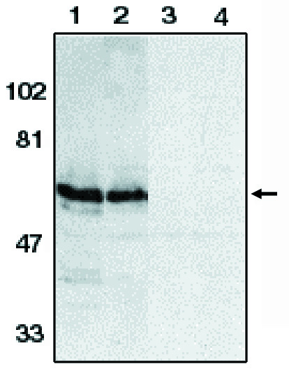 Western blot of anti-SODD (NT) antibody on HeLa (1,3) and THP-1 (2,4) whole cell lysates in the absence (1,2) and presence (3,4) of blocking peptide.
