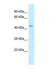 BAG4 / SODD antibody LS-C145998 Western blot of 1 Cell lysate. Antibody concentration 1 ug/ml.