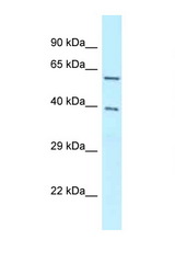 BAG4 / SODD antibody LS-C145999 Western blot of 8226 Cell lysate. Antibody concentration 1 ug/ml.
