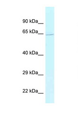 BAG5 antibody LS-C145671 Western blot of Fetal Liver lysate. Antibody concentration 1 ug/ml.