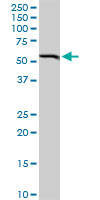 BAG5 monoclonal antibody (M02), clone 1E3. Western blot of BAG5 expression in human spleen.