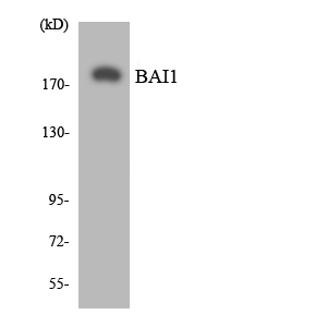 Western blot of the lysates from HUVEC cells using BAI1 antibody.