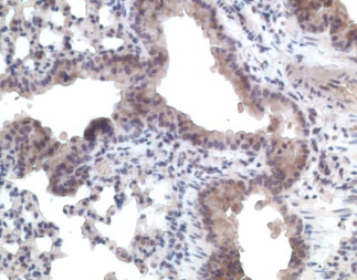 IHC of CCRL1 / CCR11 antibody LS-C83957. Formalin-fixed, paraffin-embedded mouse lung.