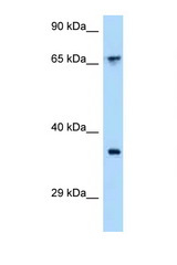 CCRL1 antibody LS-C145358 Western blot of 721_B Cell lysate. Antibody concentration 1 ug/ml.