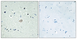 IHC of paraffin-embedded human brain tissue, using BAI3 Antibody. The sample on the right was incubated with synthetic peptide.