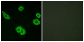 Immunofluorescence of HUVEC cells, using BAI3 Antibody. The sample on the right was incubated with synthetic peptide.