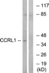 Western blot of extracts from HepG2 cells, using CCRL1 Antibody. The lane on the right is treated with the synthesized peptide.