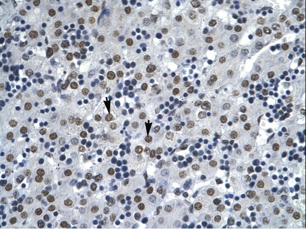 AATF antibody LS-C29956 was used in IHC to stain formalin-fixed, paraffin-embedded human liver.
