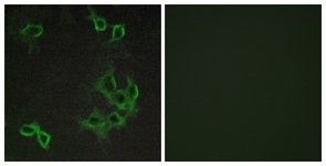 Immunofluorescence of COS7 cells, using CCRL1 Antibody. The picture on the right is treated with the synthesized peptide.