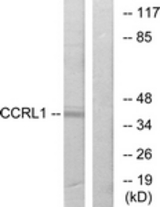 Western blot of extracts from 293 cells, using CCRL1 Antibody. The lane on the right is treated with the synthesized peptide.