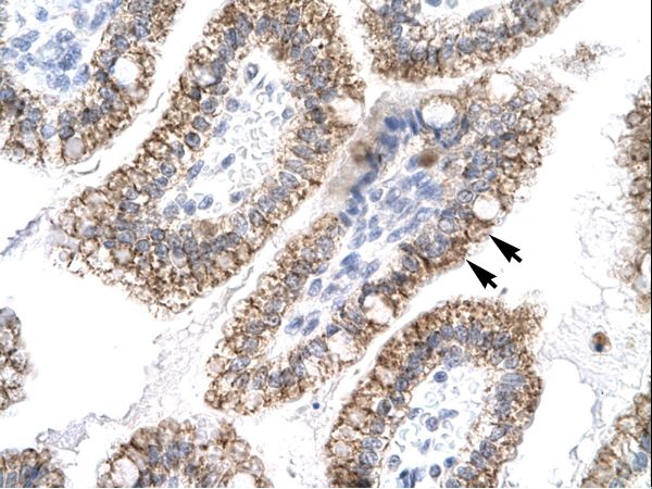 AEBP1 antibody LS-C29694 was used in IHC to stain formalin-fixed, paraffin-embedded human intestine.