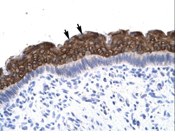 AEBP1 antibody LS-C29694 was used in IHC to stain formalin-fixed, paraffin-embedded human spermatophore.