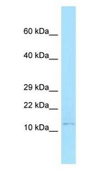 BANF1 / BAF / BCRP1 antibody Western Blot of MCF7.