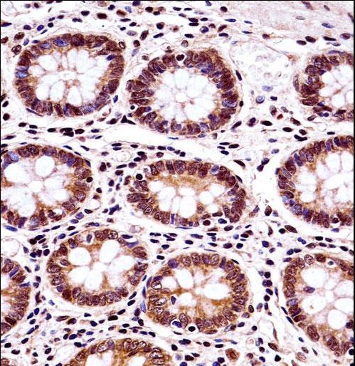 BANF1 Antibody immunohistochemistry of formalin-fixed and paraffin-embedded human colon tissue followed by peroxidase-conjugated secondary antibody and DAB staining.