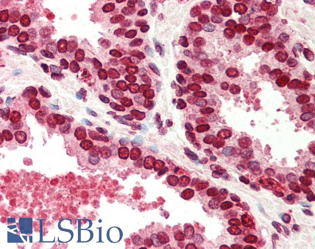 Anti-BANF1 antibody IHC of human prostate. Immunohistochemistry of formalin-fixed, paraffin-embedded tissue after heat-induced antigen retrieval. Antibody LS-B447 concentration 5 ug/ml.