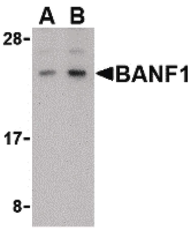 Western blot of BANF1 in human kidney tissue lysate with BANF1 antibody at (A) 0.5 and (B) 1 ug/ml.