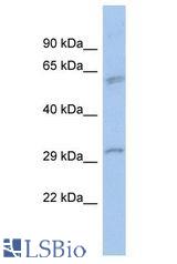 BANP antibody Western Blot of PANC1. Antibody dilution: 1 ug/ml.