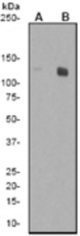 Western blot analysis on 3T3 cell lysates using anti-Phospho-ACL (pS455) antibody, 1:5000 dilution. Cells were either (A) untreated (B) treated with insulin.