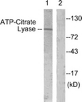Western blot of extracts from COS7 cells, treated with Calyculin 50 nM 30', using ATP-Citrate Lyase (Ab-454) Antibody. The lane on the right is treated with the synthesized peptide.