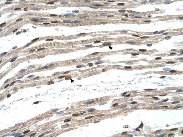 SIL1 antibody LS-C80679 was used in IHC to stain formalin-fixed, paraffin-embedded human muscle.