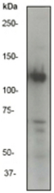 Western blot analysis on Hela cell lysate using anti-ATP citrate lyase antibody, dilution 1:5000.