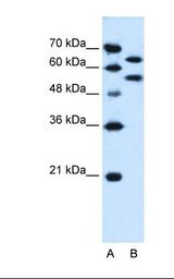 Lane A: Marker. Lane B: HepG2 cell lysate. Antibody concentration: 0.25 ug/ml. Gel concentration: 12%.
