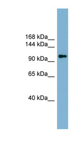 ACLY / Citrate Lyase antibody LS-C110717 Western blot of ACHN lysate.