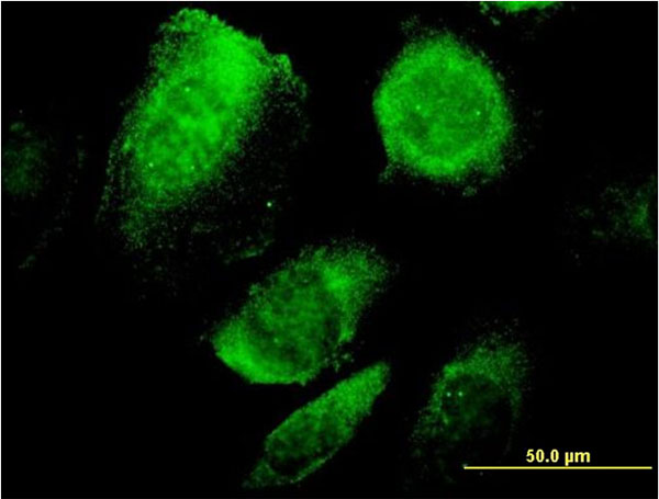 Immunofluorescence of monoclonal antibody to BCAP29 on HeLa cell. [antibody concentration 10 ug/ml]