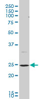 BCAP29 monoclonal antibody (M07), clone 4B10 Western blot of BCAP29 expression in PC-12.