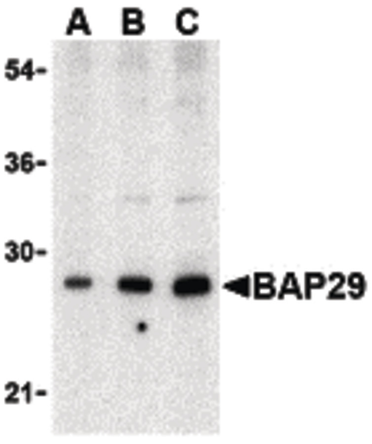 Western blot of Bap29 in human heart tissue lysate with Bap29 antibody at (A) 0.5, (B) 1 and (C) 2ug/ml.
