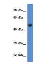BFAR antibody LS-C135126 Western blot of Mouse Brain lysate. Antibody concentration 1 ug/ml.