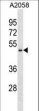 BFAR Antibody western blot of A2058 cell line lysates (35 ug/lane). The BFAR antibody detected the BFAR protein (arrow).