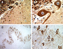 Formalin-fixed, paraffin-embedded tissue sections of normal human brain stained for BAR expression using LS-C148223 at 1:2000. A, A1: Cerebellum. B, B1: Medulla. A1 and B1 are higher magnifications of A and B, respectively.