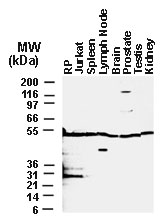 Western blot of BAR in cell lines and tissues. 25 ug of total protein was loaded per lane. BAR Recombinant protein (RP) was used as a positive control.