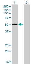Western blot of BFAR expression in transfected 293T cell line by BFAR monoclonal antibody (M01), clone 1C6.