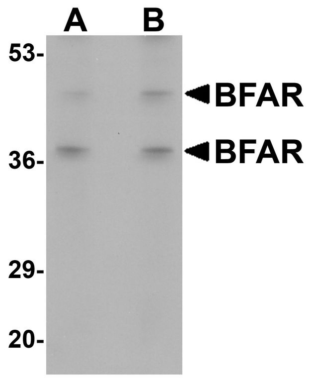 Western blot analysis of BFAR in human kidney tissue lysate with BFAR antibody at (A) 1 and (B) 2 ug/ml.
