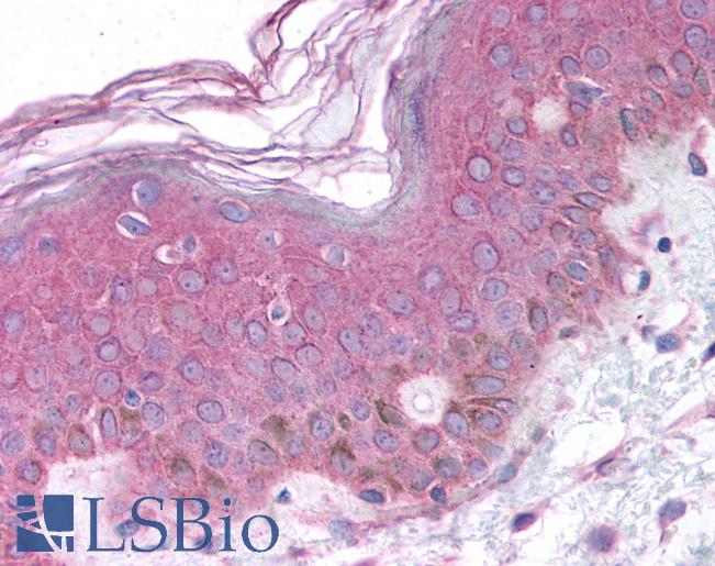 Anti-BARD1 antibody IHC of human skin. Immunohistochemistry of formalin-fixed, paraffin-embedded tissue after heat-induced antigen retrieval. Antibody LS-B794 concentration 10 ug/ml.