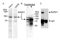 Detection of human BARD1 in nuclear extracts of HeLa and U2OS cells and in U2OS cells either expressing endogenous (-) or over-expressing (+) human BARD1 by Western blotting with Rabbit anti-Human BARD1 (LS-C43051). Immunoprecipitation of human Bard1 from nuclear extracts of HeLa cells using AHP871 (2 ug/100ug lysate) or normal rabbit IgG as a control.