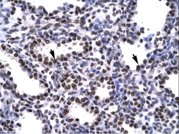 BARHL2 antibody LS-C29700 was used in IHC to stain formalin-fixed, paraffin-embedded human lung.