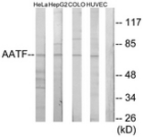 Western blot of extracts from HeLa cells/HepG2 cells/COLO205 cells/HUVEC cells, using AATF Antibody. The lane on the right is treated with the synthesized peptide.