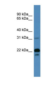 BASP1 antibody LS-C135663 Western blot of Fetal Muscle lysate.