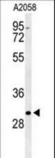 Western blot of BASP1 Antibody in A2058 cell line lysates (35 ug/lane). BASP1 (arrow) was detected using the purified antibody.