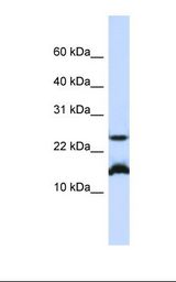 Jurkat cell lysate. Antibody concentration: 1.0 ug/ml. Gel concentration: 10-20%.