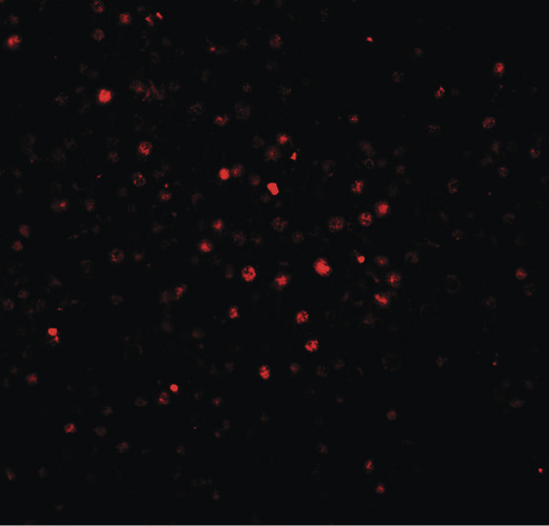 Immunofluorescence of BATF in human spleen tissue with BATF antibody at 20 ug/ml.