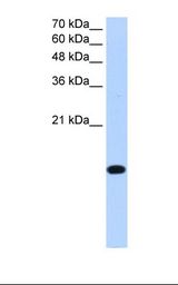 HepG2 cell lysate. Antibody concentration: 0.25 ug/ml. Gel concentration: 15%.