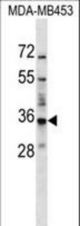 BATF2 Antibody western blot of MDA-MB453 cell line lysates (35 ug/lane). The BATF2 antibody detected the BATF2 protein (arrow).