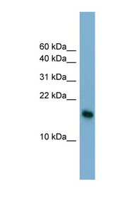 BATF3 antibody LS-C107883 Western blot of HT1080 cell lysate.