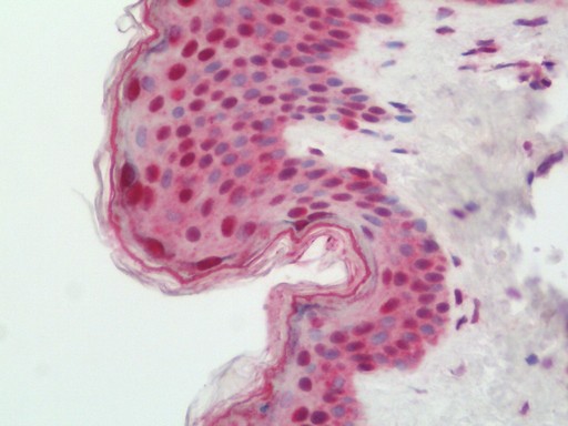 Human Skin: Formalin-Fixed, Paraffin-Embedded (FFPE)