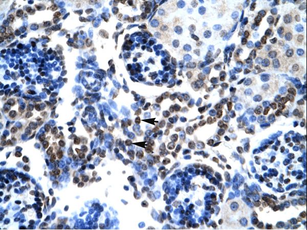BAX antibody LS-C30593 was used in IHC to stain formalin-fixed, paraffin-embedded human kidney.